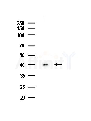 TACO1/CCDC44 Antibody - Western blot analysis of lysates from Hela cells(starvation,24h treatment), using TACO1/CCDC44 Antibody at 1/1000 dilution.