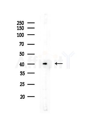 TACO1/CCDC44 Antibody - Western blot analysis of lysates from A375 cells(heat-shock,45min treatment), using TACO1/CCDC44 Antibody at 1/1000 dilution.