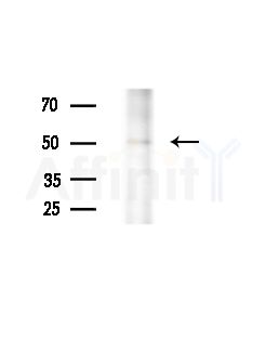 TBCE Antibody - Western blot analysis of extracts from HepG2 cells(LPS, 4h treatment), using TBCE Antibody at 1/1000 dilution.