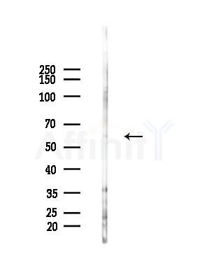 TBCE Antibody - Western blot analysis of lysates from HepG2 cells(LPS, 4h treatment), using TBCE Antibody at 1/1000 dilution.