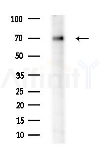 TDRKH Antibody - Western blot analysis of extracts from Rat brain, using TDRKH Antibody at 1/1000 dilution.