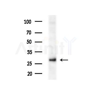 TESC Antibody - Western blot analysis of extracts from Rat brain, using TESC Antibody at 1/1000 dilution.