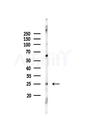 TESC Antibody - Western blot analysis of lysates from Rat brain, using TESC Antibody at 1/1000 dilution.