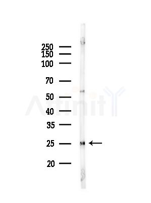 TESC Antibody - Western blot analysis of lysates from Mouse liver, using TESC Antibody at 1/1000 dilution.