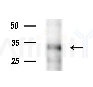 THAP2 Antibody - Western blot analysis of extracts from HUVEC cells(starvation treatment), using THAP2 Antibody at 1/1000 dilution.
