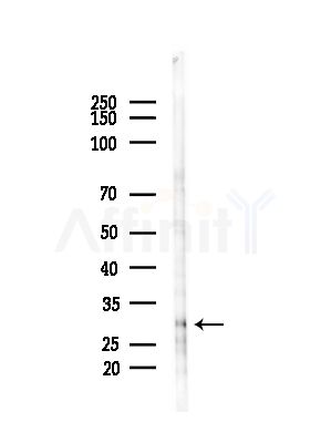 THAP2 Antibody - Western blot analysis of lysates from HUVEC cells(starvation,24h treatment), using THAP2 Antibody at 1/1000 dilution.