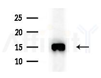 TIMM13 Antibody - Western blot analysis of extracts from COLO205 cells(heat-shock treatment), using TIMM13 Antibody at 1/1000 dilution.