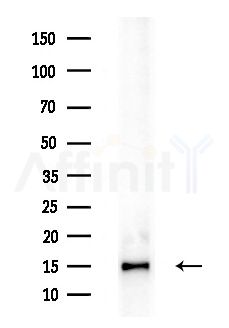 TIMM13 Antibody - Western blot analysis of extracts from Mouse liver, using TIMM13 Antibody at 1/1000 dilution.