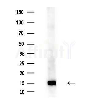TIMM13 Antibody - Western blot analysis of extracts from HUVEC cells(starvation treatment), using TIMM13 Antibody at 1/1000 dilution.