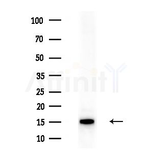 TIMM13 Antibody - Western blot analysis of extracts from Rat brain, using TIMM13 Antibody at 1/1000 dilution.