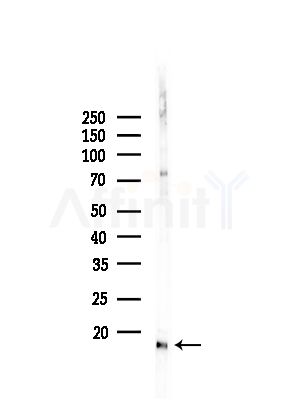 TIMM13 Antibody - Western blot analysis of lysates from Rat brain, using TIMM13 Antibody at 1/1000 dilution.