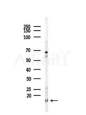 TIMM13 Antibody - Western blot analysis of lysates from HUVEC cells(starvation,24h treatment), using TIMM13 Antibody at 1/1000 dilution.