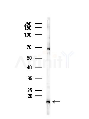 TIMM13 Antibody - Western blot analysis of lysates from COLO205 cells(heat-shock,45min treatment), using TIMM13 Antibody at 1/1000 dilution.