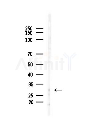 TMEM106B Antibody - Western blot analysis of lysates from HUVEC cells(starvation,24h treatment), using TMEM106B Antibody at 1/1000 dilution.