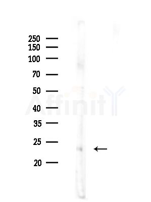 TMEM11 Antibody - Western blot analysis of lysates from A375 cells(heat-shock,45min treatment), using TMEM11 Antibody at 1/1000 dilution.