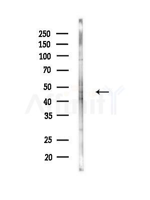 TTRAP Antibody - Western blot analysis of lysates from MDA-MB-231 cells(heat-shock, 45min treatment), using TTRAP Antibody at 1/1000 dilution.
