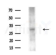 TXNL6 Antibody - Western blot analysis of extracts from HUVEC cells(starvation treatment), using TXNL6 Antibody at 1/1000 dilution.