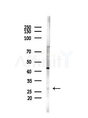 TXNL6 Antibody - Western blot analysis of lysates from HUVEC cells(starvation,24h treatment), using TXNL6 Antibody at 1/1000 dilution.