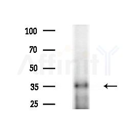 UCK2 Antibody - Western blot analysis of extracts from HUVEC cells(starvation treatment), using UCK2 Antibody at 1/1000 dilution.