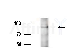 VPS39 Antibody - Western blot analysis of extracts from COLO205 cells(heat-shock treatment), using VPS39 Antibody at 1/1000 dilution.