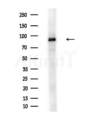 XAB2 Antibody - Western blot analysis of extracts from COLO205 cells(heat-shock treatment), using XAB2 Antibody at 1/1000 dilution.