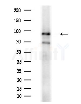 XAB2 Antibody - Western blot analysis of extracts from HUVEC cells(starvation treatment), using XAB2 Antibody at 1/1000 dilution.