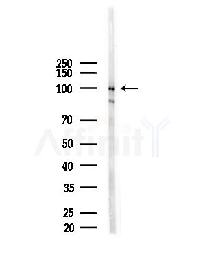 XAB2 Antibody - Western blot analysis of lysates from HUVEC cells(starvation,24h treatment), using XAB2 Antibody at 1/1000 dilution.