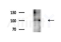 XPO6 Antibody - Western blot analysis of extracts from COLO205 cells(heat-shock treatment), using XPO6 Antibody at 1/1000 dilution.