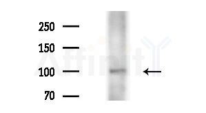 XPO6 Antibody - Western blot analysis of extracts from Mouse liver, using XPO6 Antibody at 1/1000 dilution.