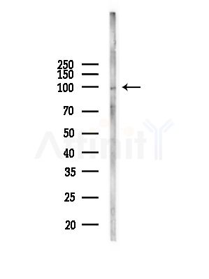 XPO6 Antibody - Western blot analysis of lysates from Mouse liver, using XPO6 Antibody at 1/1000 dilution.
