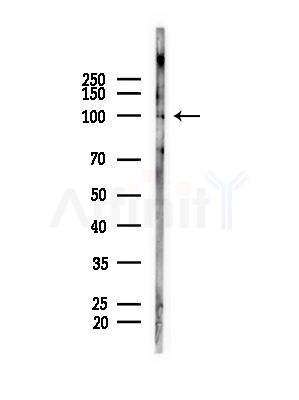 XPO6 Antibody - Western blot analysis of lysates from COLO205 cells(heat-shock,45min treatment), using XPO6 Antibody at 1/1000 dilution.