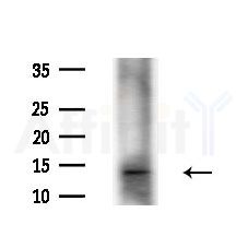 YPEL3 Antibody - Western blot analysis of extracts from Mouse testis, using YPEL3 Antibody at 1/1000 dilution.