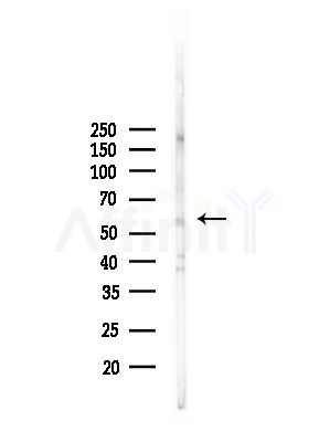 ZNF238 Antibody - Western blot analysis of lysates from Rat brain, using ZNF238 Antibody at 1/1000 dilution.