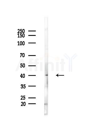 ACAT2 Antibody - Western blot analysis of lysates from Mouse liver, using ACAT2 Antibody at 1/1000 dilution.