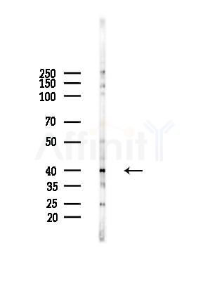 ACAT2 Antibody - Western blot analysis of lysates from HepG2 cells(starvation treatment), using ACAT2 Antibody at 1/1000 dilution.
