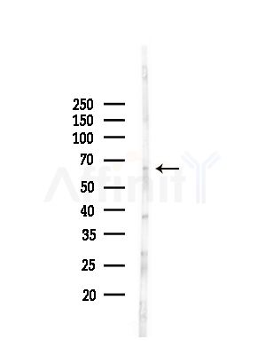 ACSM3 Antibody - Western blot analysis of lysates from Rat brain, using ACSM3 Antibody at 1/1000 dilution.