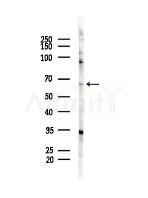 ACSM3 Antibody - Western blot analysis of lysates from COLO205 cells(heat-shock,45min treatment), using ACSM3 Antibody at 1/1000 dilution.