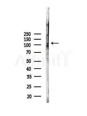 AFAP1 Antibody - Western blot analysis of lysates from Rat brain, using AFAP1 Antibody at 1/1000 dilution.