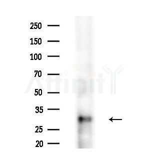 AFMID Antibody - Western blot analysis of extracts from COLO205 cells(heat-shock treatment), using AFMID Antibody at 1/1000 dilution.