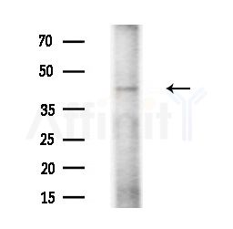 AIPL1 Antibody - Western blot analysis of extracts from HUVEC cells(starvation treatment), using AIPL1 Antibody at 1/1000 dilution.