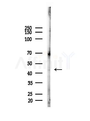 AIPL1 Antibody - Western blot analysis of lysates from HUVEC cells(starvation,24h treatment), using AIPL1 Antibody at 1/1000 dilution.