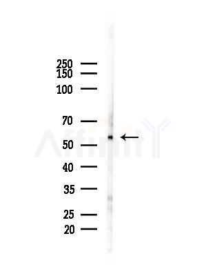 Ajuba Antibody - Western blot analysis of lysates from HUVEC cells(starvation,24h treatment), using Ajuba Antibody at 1/1000 dilution.