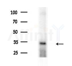 AKR7A3 Antibody - Western blot analysis of extracts from HUVEC cells(starvation treatment), using AKR7A3 Antibody at 1/1000 dilution.