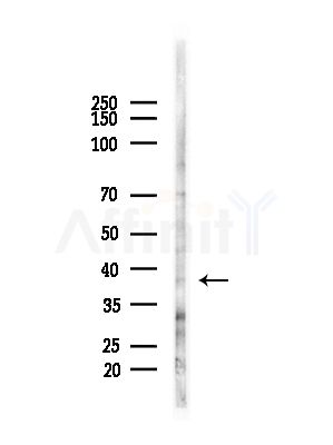 AKR7A3 Antibody - Western blot analysis of lysates from HUVEC cells(starvation,24h treatment), using AKR7A3 Antibody at 1/1000 dilution.