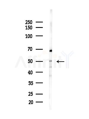 ALDH5A1 Antibody - Western blot analysis of lysates from LoVo cells(heat-shock,45min treatment), using ALDH5A1 Antibody at 1/1000 dilution.
