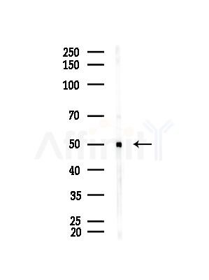 ALDH5A1 Antibody - Western blot analysis of lysates from Rat brain, using ALDH5A1 Antibody at 1/1000 dilution.