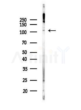 AP3D1 Antibody - Western blot analysis of lysates from PC12 cells(LPS, 4h treatment), using AP3D1 Antibody at 1/1000 dilution.