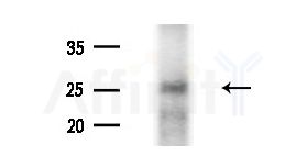 ARD1A Antibody - Western blot analysis of extracts from HUVEC cells(starvation treatment), using ARD1A Antibody at 1/1000 dilution.