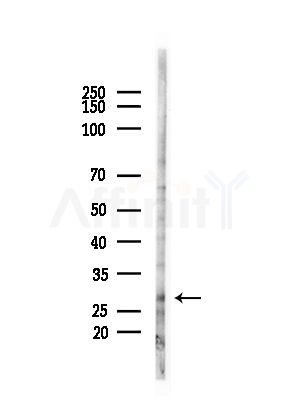 ARD1A Antibody - Western blot analysis of lysates from HUVEC cells(starvation,24h treatment), using ARD1A Antibody at 1/1000 dilution.