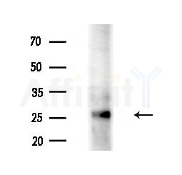 ARD1B Antibody - Western blot analysis of extracts from HUVEC cells(starvation treatment), using ARD1B Antibody at 1/1000 dilution.